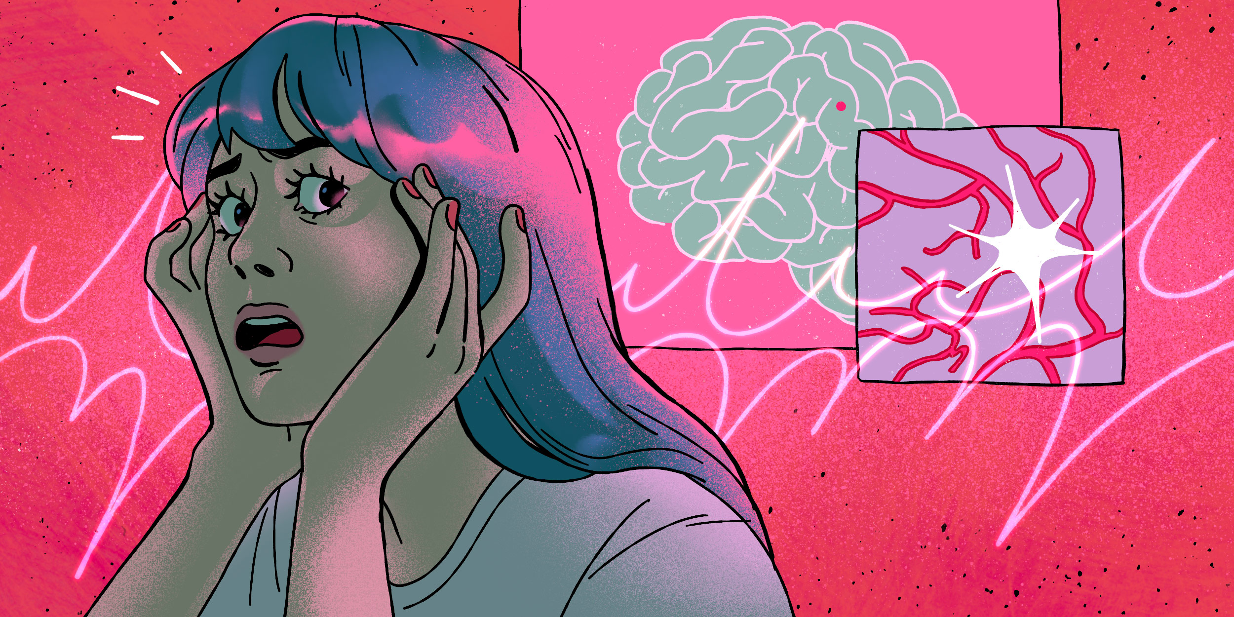 Существует ли на самом деле предынсультное состояние: разбираемся с неврологом