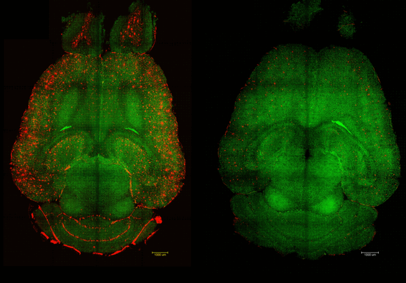 Вчені вилікували Альцгеймера у мишей єдиним уколом